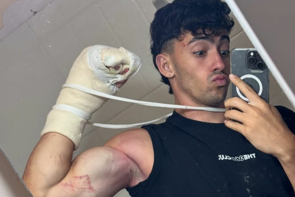 Gero Arias supera retos extremos y desafía límites. Foto: Instagram @geroooo_arias.