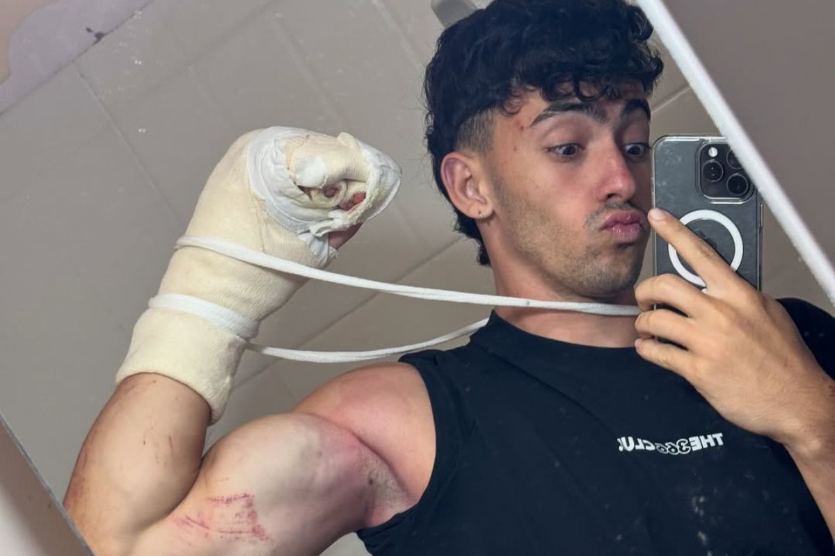 (Video) El 'influencer' Gero Arias sufrió un accidente serio y perdió