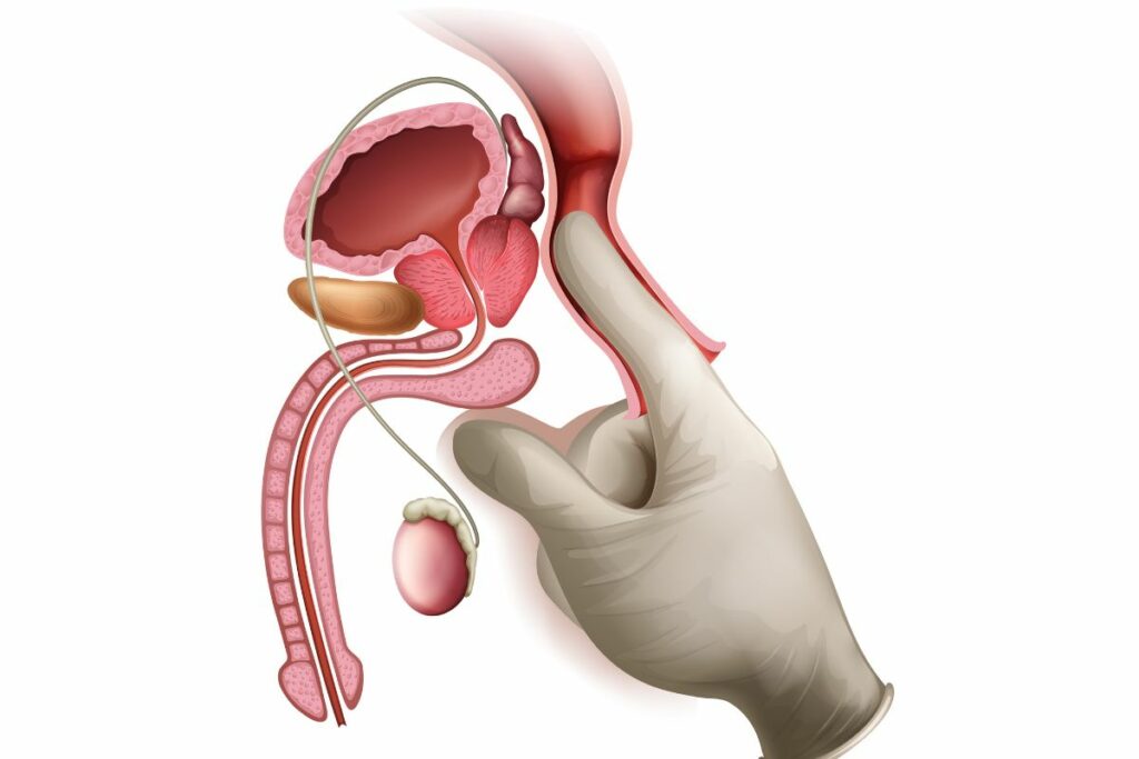El diagnóstico del cáncer de próstata se realiza mediante pruebas como el examen físico, y la ecografía transrectal. Foto: Freepik.