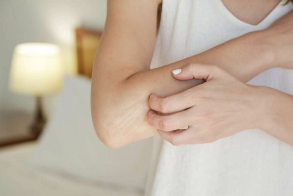 Investigadores advierten sobre los efectos de rascarse un sarpullido. Foto: Pexels