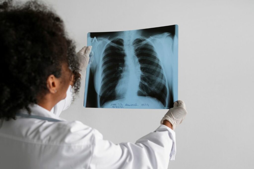 Imagen referencial de diagnóstico de tuberculosis.