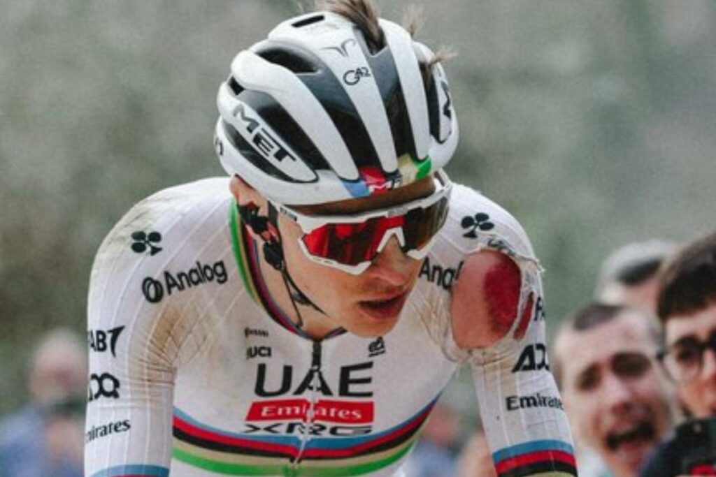 Tadej Pogacar sufrió una dura caída pero se levantó para ganar la Strade Bianche.