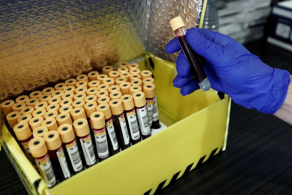 Imagen referencial de muestras de sangre en un laboratorio.