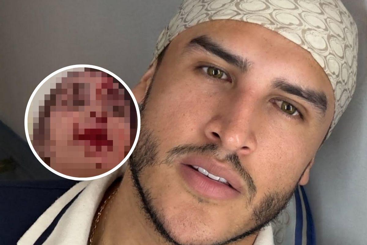 Estilista es arrestado en Cannes, acusado de agredir a una modelo