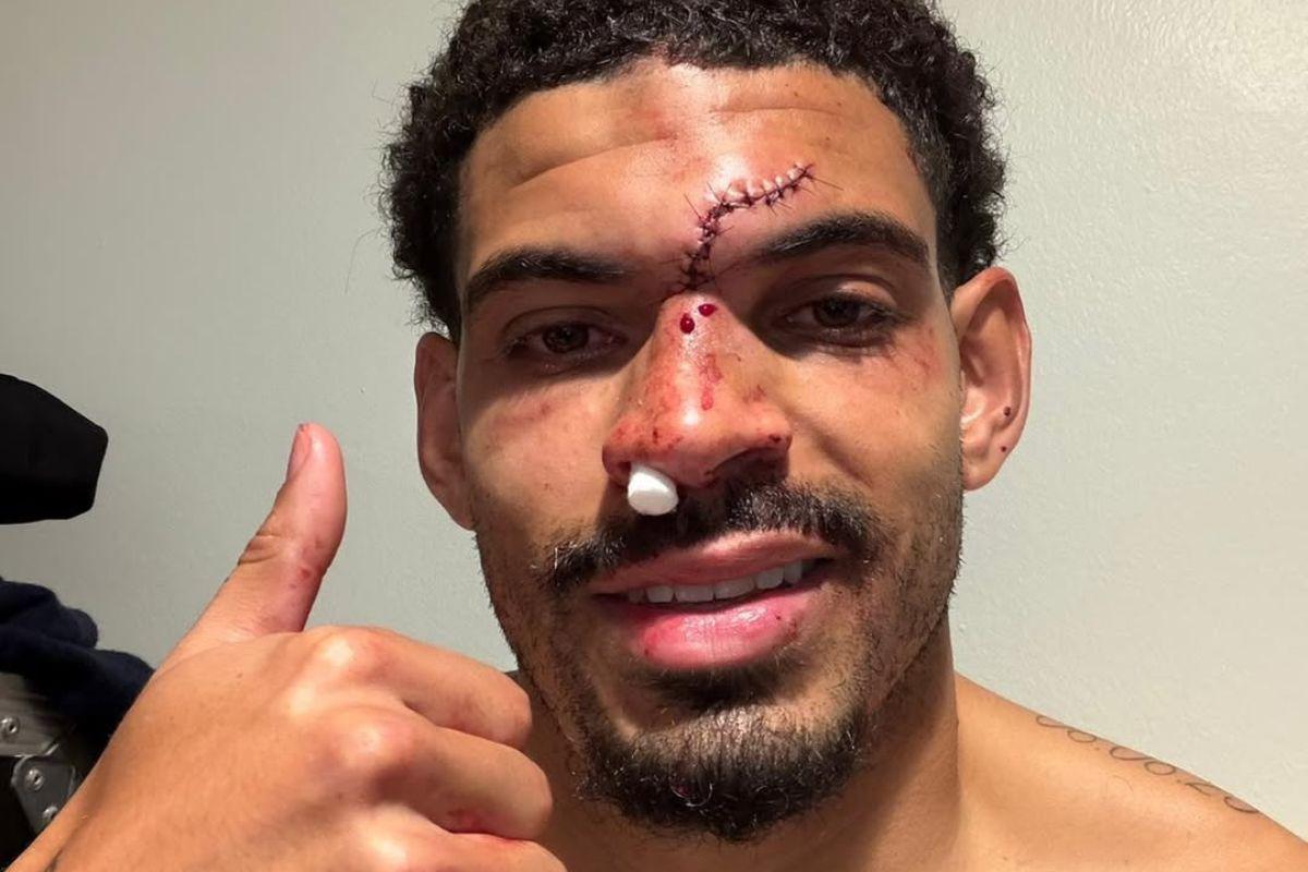 Morgan Gibbs-White sufre impactante choque en la Premier League